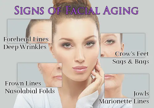 Signs of Facial Aging